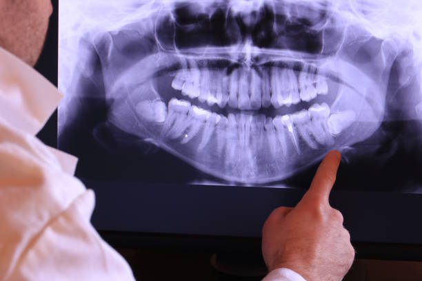 Best Emergency Dentist for Knocked-Out Tooth in Burke Centre, VA